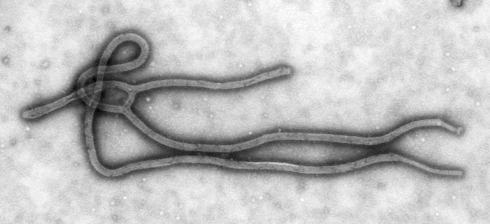 Le térrible virus Ebola